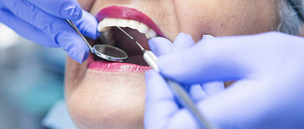 Best Chipped Tooth Repair Near Me  in Quincy, WA