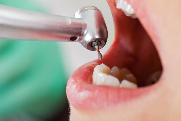 Best Root Canal Emergency Dentist  in Quincy, WA